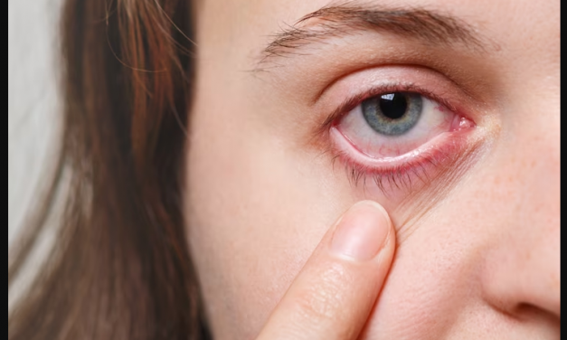 Referensi Obat Sakit Mata dan Pencegahan Sakit Mata